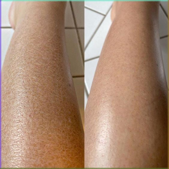 Gant Exfoliant Culottissime